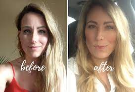 Maybe you would like to learn more about one of these? A Personal Experience With Getting Rid Of Forehead Lines