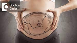 Can One Alter Fetal Position From Tranverse Position In 32 Weeks Of Gestation Dr Nupur Sood Youtube