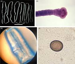 Tapeworms An Overview Sciencedirect Topics