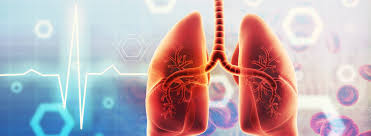 Image result for Pulmonary Intoxicant