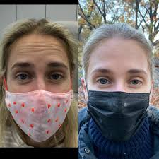 Recently had too much fun with my friend Caroline, who was a Botox first  timer and whose single “How many shots can you get in your face?” is  dropping soon (sound on).