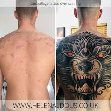 They could be covering up poorly done tattoos or covering up scars from a mastectomy, self harm, an accident or other things. Scar Cover Up Tattoos Holmfirth Huddersfield West Yorkshire