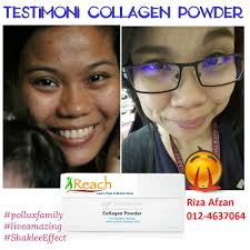 February 18, 2016 didie leave a comment. Cara Menghilangkan Sunburn Guna Bahan Semulajadi Yang Boleh Dibeli Di Pasar Je