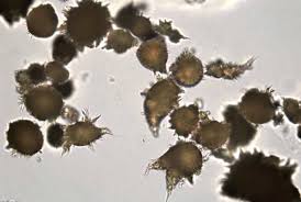 All forms are colorless or white. Cristaux Urinaires Massart Sante Materiel Medical Et De Laboratoire