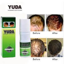 False unless you empty half a bottle of the stuff onto your hair each day. Yunnan Yuda Hair Growth Spray 100 Herbal Hair Growing Formula Buy Hair Growth Spray Organic Hair Spray Yuda Pilatory Hair Growth Product On Alibaba Com