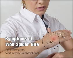 Your dog is also likely to suffer from bites. Wolf Spider Bite Symptoms Treatment Prevention Diagnosis