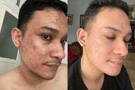 Kupas Tuntas Perbedaan 2 Varian Somethinc Niacinamide Serum yang Laris  Manis
