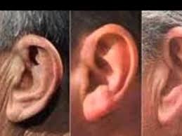 تفسير الأذن في المنام للشيخ ثامر العامر Youtube