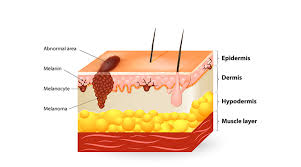 Symptoms and treatment of skin cancer vary greatly depending on the form and stage of the lesion. Skin Cancers Medical Dermatology Board Certified Dermatologist Kevin Welch Md