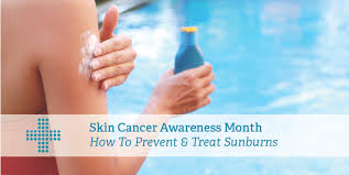 How do you know if you might have skin cancer? Skin Cancer Awareness Month Sunburns Patient Plus Urgent Care Clinic Baton Rouge