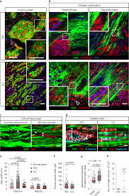 Check spelling or type a new query. Wzsqovi7pbg2km