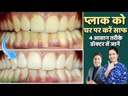 Rub the floss up and down gently, continuing to press. Removal Of Plaque From Teeth Home Remedy Danto Ka Plaque Kaise Hataye à¤¦ à¤¤ à¤• à¤¸à¤« à¤ˆ Episode 18 Alltolearn Blog
