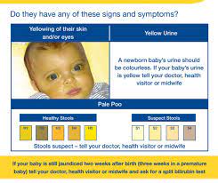 Children S Liver Disease Foundation Often Parents Are Reassured That Jaundice Is Not A Concern But If A Baby Is Still Jaundiced Two Weeks After Birth Three For Premature Babies It Is