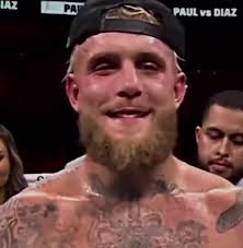 Picture of Logan After Jake Diaz Fight