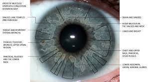 Eye Iridology Surprising Findings Iris The Picture Of Health
