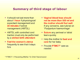 Image result for Active Management of Labor