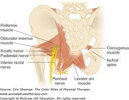 Low Back Pain Without Sciatica Icd 10