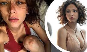 Record and instantly share video messages from your browser. The Undoing S Matilda De Angelis Struggled With Anorexia As A Teenager And Sought A Attention Daily Mail Online