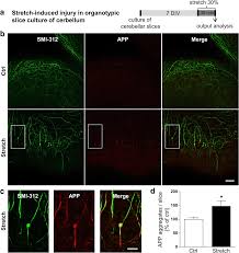 Lie on your back with your hands on the ground in low v, knees bent, and feet flat on the floor. Figure 1 Mechanical Stretch Of High Magnitude Provokes Axonal Injury Elongation Of Paranodal Junctions And Signaling Alterations In Oligodendrocytes Springerlink