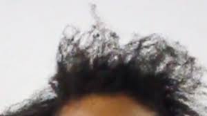 Upload, livestream, and create your own videos, all in hd. Thinning Hair Causes Remedies For African American Women Hair Youtube