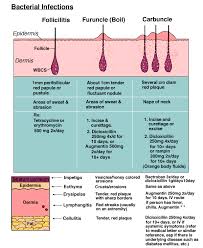 Bacterial Infections Medical Knowledge Home Health Nurse Nursing School Studying