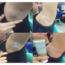 Peopleimages/getty images whether your back has just a few patches of peach fuzz or it's straight u. Strip Off Hair Removal Cream 100g Shopee Philippines