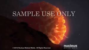 Timing of the intrauterine insemination is also very important. Home Insemination Guide