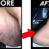 How to lighten skin ? 1