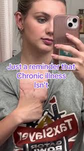I debated posting this, but in full transparency, i wanted to show you what  I have been dealing with since last August. I contracted mono in early  August after eating a piece of pizza my brother had ...