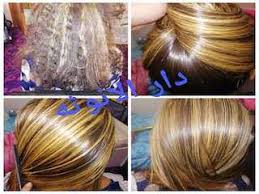 فوائد متعددة يقدمها الزنجبيل لصحة الشعر. Ø§Ù†ÙˆØ§Ø¹ Ø§Ù„Ø¨Ø±ÙˆØªÙŠÙ† 0558675643 Ø¯Ø§Ø±Ø§Ù„Ø§Ù†ÙˆØ«Ø© Ø§ÙØ¶Ù„ Ø§Ù†ÙˆØ§Ø¹ Ø§Ù„Ø¨Ø±ÙˆØªÙŠÙ† Ø§Ù„Ø¨Ø±Ø§Ø²ÙŠÙ„ÙŠ