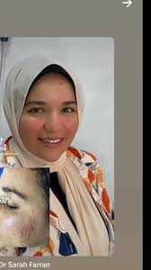 د ساره فران واحده بس 😉👌, جلستنا غير اي كلينك, لان د ساره بتتشغل بمنتجات  من شركه الفران بيوتي 😉, يعني اعلي و احسن نتيجه ❤️