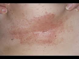 Pin On Health