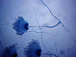 Image result for Asparagus aspergillus