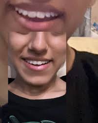 Dr Rubab Tariq Butt (@dentalhubclinic) • Instagram photos and videos