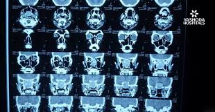 Ct Scan Cost In Yashoda Hospital Ct Scan Machine
