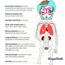 1 Lupusawareness Tumblr Lupus Awareness Lupus Rash On Face
