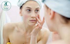 Hiện Tượng Da Bị Tăng Sắc Tố Sau Lăn Kim, Laser Và Peel Da