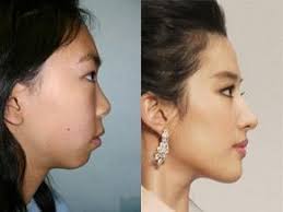 What makes a Stacy vs a Becky : r/Vindicta