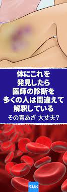 病気の兆候かも 青あざができる原因 ホルモン異常や薬物など考えられる7つの原因 青あざ 原因 あざ 病気 兆候 白血病 糖尿病 症状 よくぶつけるわけでもないのに痣ができていたら ちょっと注意が必要です もしかしたら別の理由から痣ができているのかも
