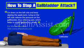 Pin On Abdominal Pain