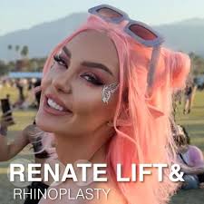 Renate Lift and rhinoplasty .✨ For detailed information; ☎ +90 538 659 60  00 📧 info@renateclinic.com 📍Istanbul