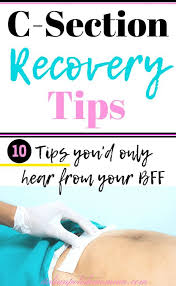 C Section Recovery Tips C Section Recovery C Section New Baby Products