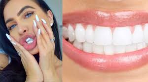 Check out these awesome home remedies to remove plaque effectively. Diy Remove Plaque Tartar From Teeth At Home 100 Works How To Naturally Get Whitest Teeth Ever Youtube
