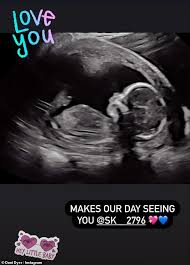 Lou is a chromatic brawler that can be unlocked as a brawl pass reward at tier 30 from season 4: Pregnant Dani Dyer Gushes That She Felt Her Baby Move For The First Time Despite Having An Anterior Placenta