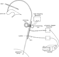 A New Method For Measuring Cerebrospinal Fluid Flow In