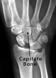 Image result for Capitate Bone