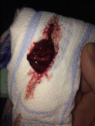 While a pregnancy can end at any time, these are the points when certain things are most noticeable such asonly seeing clots, seeing the pregnancy sac with an embryo, to seeing a fully formed baby. Blood Clot Or Miscarriage Glow Community