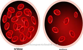 Pesakit talasemia intermedia yang tidak memerlukan transfusi darah, juga boleh mendapat peningkatan besi di dalam badannya. Talasemia Sebab Gejala Rawatan Penyakit