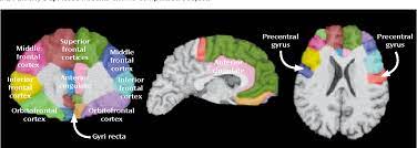 Celiskili durumlar, zor kararlar, refleksle celisen eylemleri gerceklestirebilmek icin. Figure 3 From Anterior Cingulate Gyrus Rectus And Orbitofrontal Abnormalities In Elderly Depressed Patients An Mri Based Parcellation Of The Prefrontal Cortex Semantic Scholar