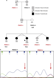 Image result for Tic Disorder